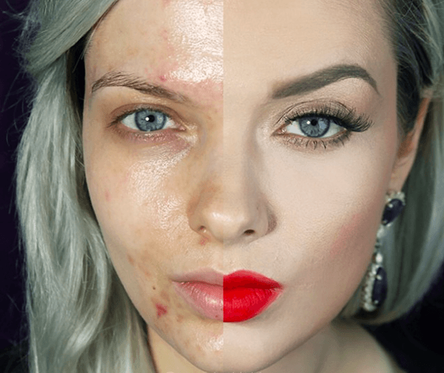 bloguera con acné se quita el maquillaje