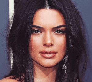 Kendall Jenner con acné