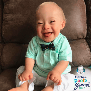 bebé Gerber con síndrome de Down